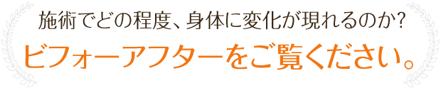施術でどの程度、身体に変化が現れるのか?ビフォーアフターをご覧ください。